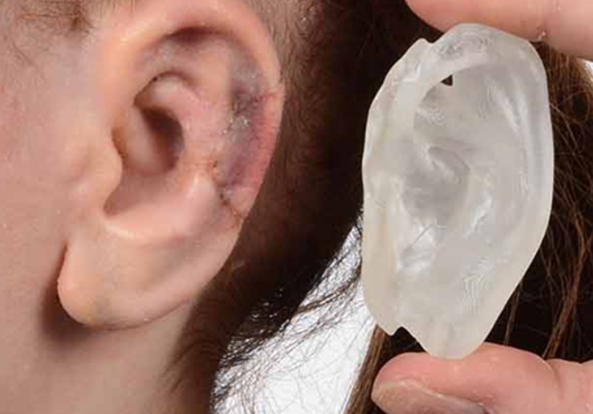 traumatic hearing loss treatment in Mumbai